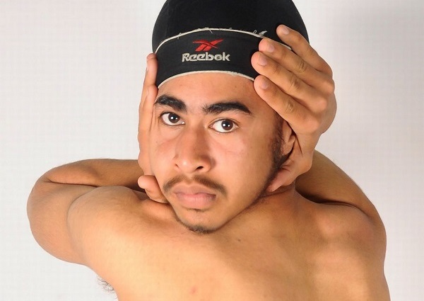 Người đàn ông có khả năng xoay ngược đầu 180 độ