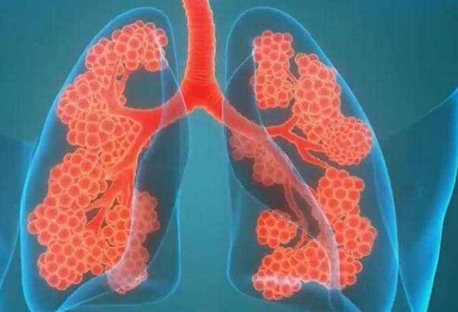 Họ lưu ý rằng chụp MRI xenon siêu cực đại (XeMRI) đã phát hiện thấy những bất thường trong phổi của một số bệnh nhân COVID-19 hơn ba tháng sau khi xuất viện. Ảnh: Twitter / @ HospitalsApollo