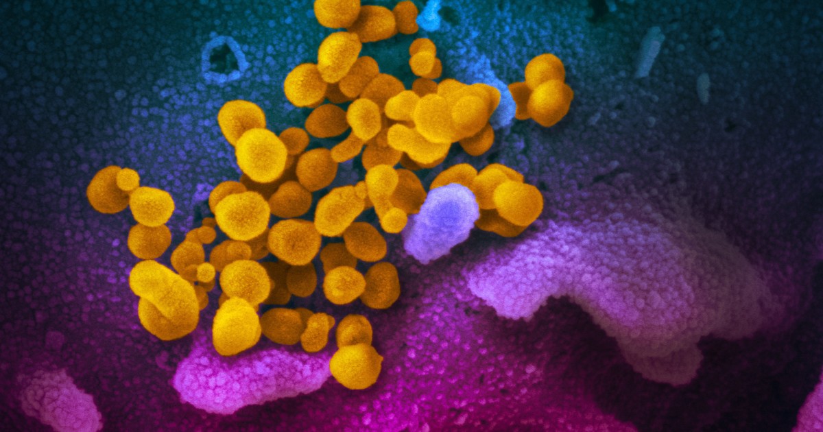 Coronavirus COVID-19 có màu vàng, nổi lên từ các tế bào (có màu xanh và hồng) được nuôi cấy trong phòng thí nghiệm. Hình ảnh này là từ kính hiển vi điện tử quét.