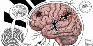 Bí Mật Đáng Sợ Về Thực Phẩm Chế Biến Sẵn – Não Bộ Bị Tổn Hại